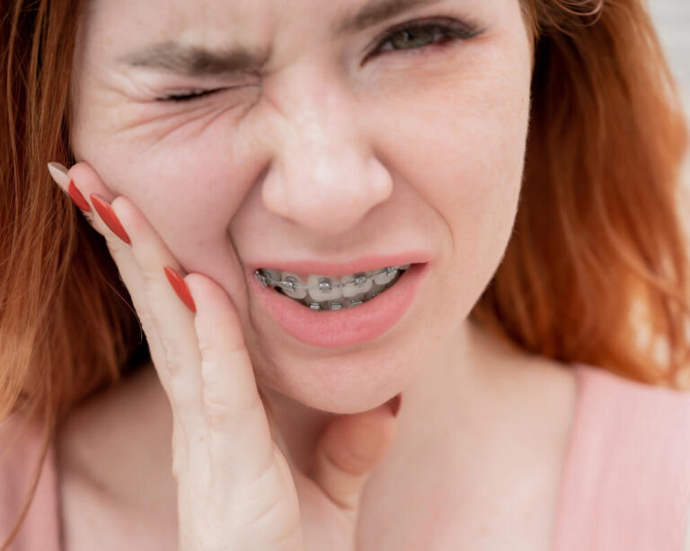 How Long Do Braces Hurt? How Much Time Does Brace Pain Last?
